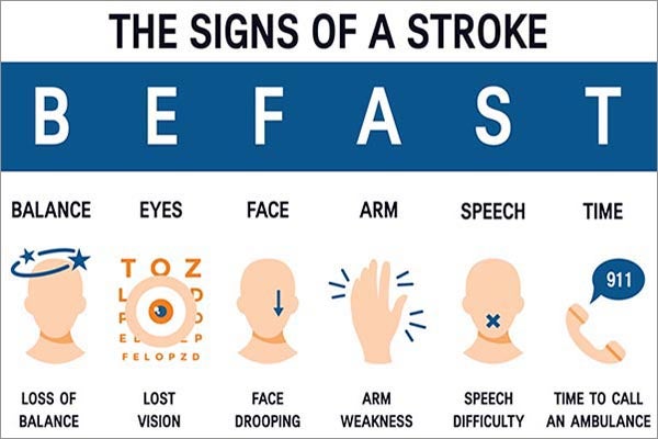 Stroke BE FAST